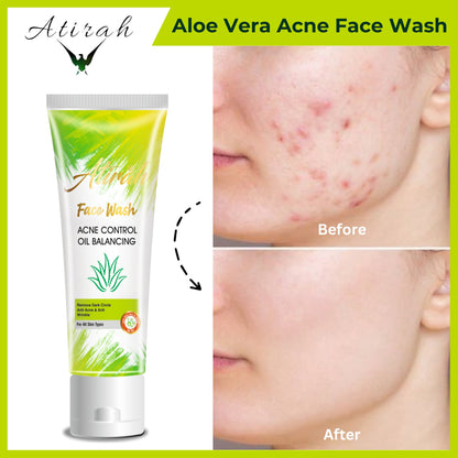 Atirah Aloe Vera Acne Face Wash – 100ml