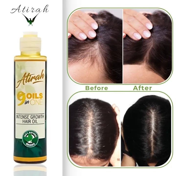 ATIRAH 100% Organic 9-in-1 Hair Growth Oil  120ml